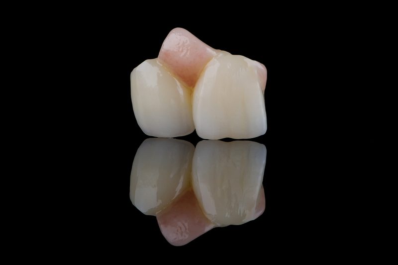 Pink gingival porcelain dental add-on